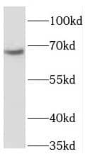 Western Blot: PGBD3 Antibody - BSA Free [NBP3-47175] - HeLa cells were subjected to SDS PAGE followed by western blot with (PGBD3 antibody) at dilution of 1:500