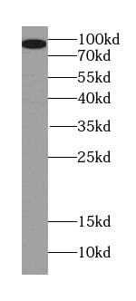 Western Blot PGAP1 Antibody - BSA Free