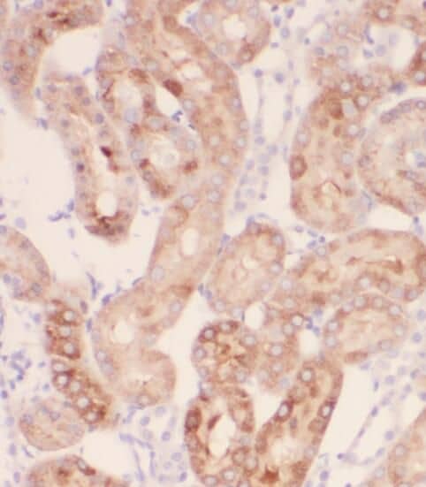 Immunohistochemistry PEX11G Antibody - BSA Free