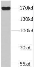Western Blot: APRIN Antibody - BSA Free [NBP3-47184] - HT-1080 cells were subjected to SDS PAGE followed by western blot with (APRIN antibody) at dilution of 1:400