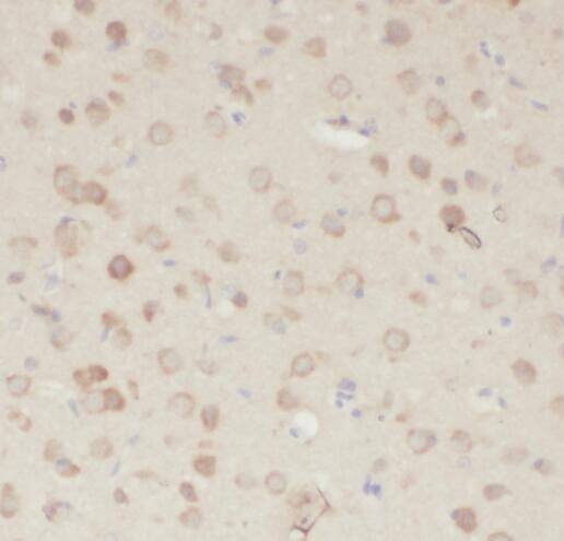 Immunohistochemistry: PDE7B Antibody - BSA Free [NBP3-47187] - Immunohistochemistry of paraffin-embedded human brain using (PDE7B antibody) at dilution of 1:100