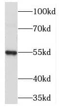 Western Blot: PDE6C Antibody - BSA Free [NBP3-47188] - Y79 cells were subjected to SDS PAGE followed by western blot with (PDE6C antibody) at dilution of 1:3000