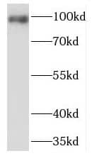 Western Blot: PDE6 beta Antibody - BSA Free [NBP3-47189] - A549 cells were subjected to SDS PAGE followed by western blot with (PDE6 beta antibody) at dilution of 1:3000
