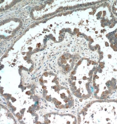 Immunohistochemistry PDE6A Antibody - BSA Free