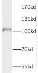 Western Blot: PDE6A Antibody - BSA Free [NBP3-47190] - Human brain tissue were subjected to SDS PAGE followed by western blot with (PDE6A antibody) at dilution of 1:500