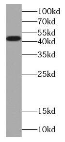 Western Blot: PCYT1B Antibody - BSA Free [NBP3-47193] - Human placenta tissue were subjected to SDS PAGE followed by western blot with (PCYT1B antibody) at dilution of 1:500