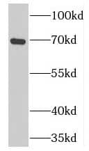 Western Blot: Proprotein Convertase 7/PCSK7 Antibody - BSA Free [NBP3-47196] - Mouse spleen tissue were subjected to SDS PAGE followed by western blot with (Proprotein Convertase 7/PCSK7 Antibody) at dilution of 1:300