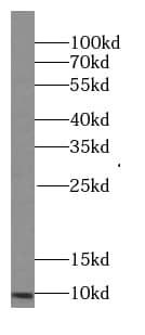 Western Blot IQM1 Antibody - BSA Free