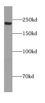 Western Blot: PCNXL2 Antibody - BSA Free [NBP3-47199] - HeLa cells were subjected to SDS PAGE followed by western blot with (PCNXL2 antibody) at dilution of 1:500