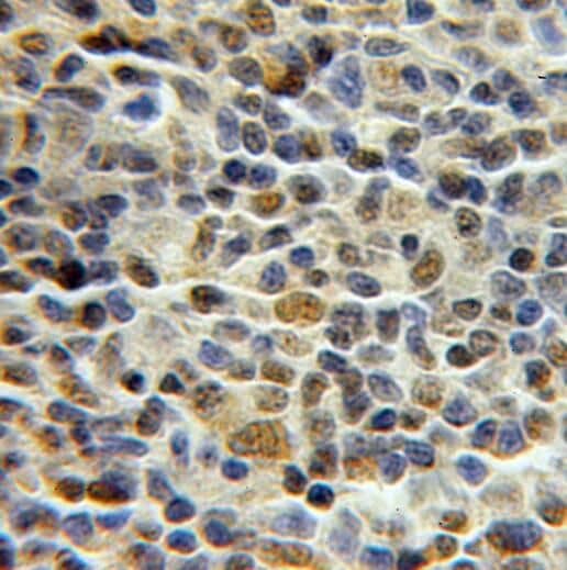 Immunohistochemistry PCNP Antibody - BSA Free