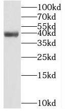 Western Blot: PCGF6 Antibody - BSA Free [NBP3-47202] - PC-13 cells were subjected to SDS PAGE followed by western blot with (PCGF6 antibody) at dilution of 1:800