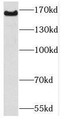 Western Blot: PCDH9 Antibody - BSA Free [NBP3-47210] - Mouse brain tissue were subjected to SDS PAGE followed by western blot with (PCDH9 antibody) at dilution of 1:600