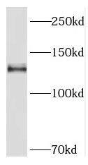 Western Blot PCDH11Y Antibody - BSA Free
