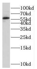 Western Blot: PCCB Antibody - BSA Free [NBP3-47212] - Mouse heart tissue were subjected to SDS PAGE followed by western blot with ( PCCB Antibody) at dilution of 1:600