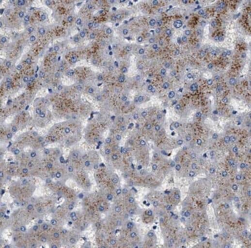 Immunohistochemistry: PCCA Antibody - BSA Free [NBP3-47213] - Immunohistochemistry of paraffin-embedded human liver tissue slide using (PCCA Antibody) at dilution of 1:200