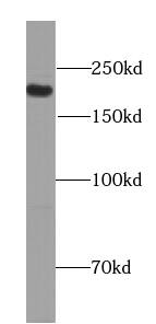 Western Blot: PC6 Antibody - BSA Free [NBP3-47215] - Mouse brain tissue were subjected to SDS PAGE followed by western blot with (PC6 Antibody) at dilution of 1:300