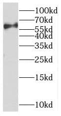 Western Blot: PARP6 Antibody - BSA Free [NBP3-47219] - HepG2 cells were subjected to SDS PAGE followed by western blot with (PARP6 antibody) at dilution of 1:300