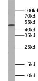 Western Blot: PARP15 Antibody - BSA Free [NBP3-47220] - A431 cells were subjected to SDS PAGE followed by western blot with (PARP15 antibody) at dilution of 1:500