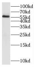 Western Blot: PAOX Antibody - BSA Free [NBP3-47225] - Human stomach tissue were subjected to SDS PAGE followed by western blot with (PAOX antibody) at dilution of 1:500