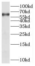 Western Blot: PANK1 Antibody - BSA Free [NBP3-47226] - Raji cells were subjected to SDS PAGE followed by western blot with (PANK1 antibody) at dilution of 1:300