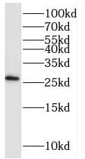 Western Blot: PAIP2 Antibody - BSA Free [NBP3-47228] - A431 cells were subjected to SDS PAGE followed by western blot with (PAIP2 antibody) at dilution of 1:500