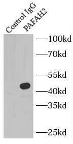 Immunoprecipitation PAFAH2 Antibody - BSA Free