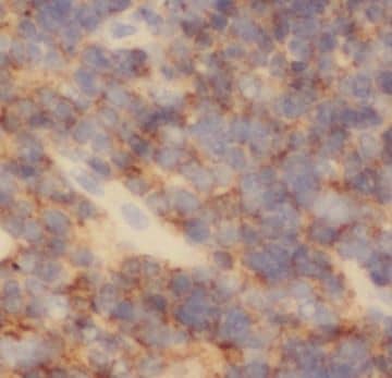 Immunohistochemistry PAFAH2 Antibody - BSA Free