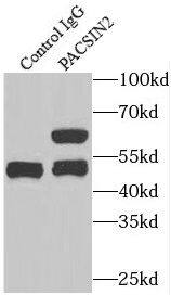 Immunoprecipitation: PACSIN2 Antibody - BSA Free [NBP3-47232] - IP Result of anti-PACSIN2 (IP:, 4ug; Detection: 1:500) with NIH/3T3 cells lysate 1200ug.