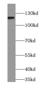 Western Blot: PACS2 Antibody - BSA Free [NBP3-47233] - Mouse brain tissue were subjected to SDS PAGE followed by western blot with (PACS2 antibody) at dilution of 1:600