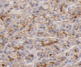 Immunohistochemistry PACS2 Antibody - BSA Free
