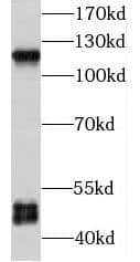 Western Blot: P2X5/P2RX5 Antibody - BSA Free [NBP3-47236] - BxPC-3 cells were subjected to SDS PAGE followed by western blot with (P2X5/P2RX5 antibody) at dilution of 1:600