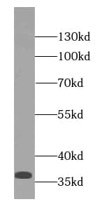 Western Blot: P15RS Antibody - BSA Free [NBP3-47237] - Mouse skeletal muscle tissue were subjected to SDS PAGE followed by western blot with (P15RS antibody) at dilution of 1:1000