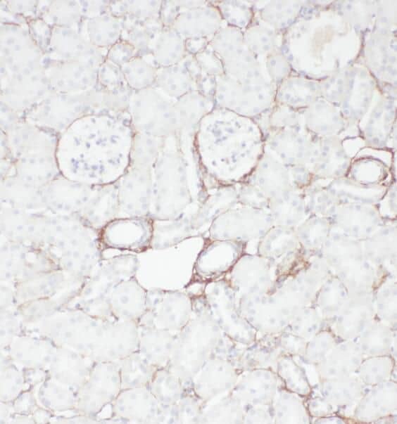 Immunohistochemistry: OXER1/5-oxo-ETE GPCR Antibody - BSA Free [NBP3-47238] - Immunohistochemistry of paraffin-embedded human kidney using (OXER1/5-oxo-ETE GPCR antibody) at dilution of 1:50