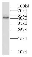 Western Blot: OXER1/5-oxo-ETE GPCR Antibody - BSA Free [NBP3-47238] - K-562 cells were subjected to SDS PAGE followed by western blot with (OXER1/5-oxo-ETE GPCR antibody) at dilution of 1:500