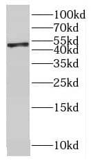 Western Blot OVCA1 Antibody - BSA Free