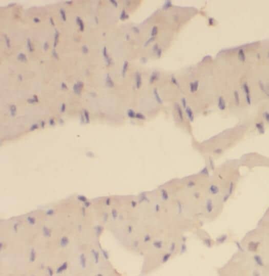 Immunohistochemistry OVCA1 Antibody - BSA Free