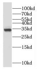 Western Blot: OTUD6A Antibody - BSA Free [NBP3-47243] - MCF-7 cells were subjected to SDS PAGE followed by western blot with ( OTUD6A Antibody) at dilution of 1:1000