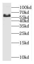 Western Blot: OSR1 Antibody - BSA Free [NBP3-47246] - HeLa cells were subjected to SDS PAGE followed by western blot with (OSR1 antibody) at dilution of 1:1000