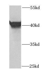 Western Blot: OSGEPL1 Antibody - BSA Free [NBP3-47248] - HeLa cells were subjected to SDS PAGE followed by western blot with ( OSGEPL1 Antibody) at dilution of 1:1000