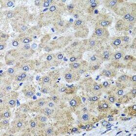 Immunohistochemistry: OSGEPL1 Antibody - BSA Free [NBP3-47248] - Immunohistochemistry of paraffin-embedded human liver injury using ( OSGEPL1 Antibody) at dilution of 1:100