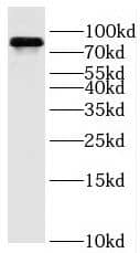 Western Blot OSBPL11 Antibody - BSA Free