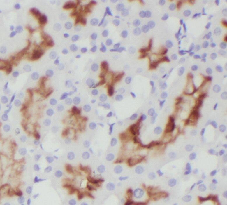 Immunohistochemistry Orai2 Antibody - BSA Free