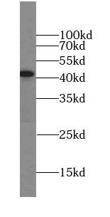 Western Blot: CCDC16 Antibody - BSA Free [NBP3-47257] - HeLa cells were subjected to SDS PAGE followed by western blot with (CCDC16 antibody) at dilution of 1:1000
