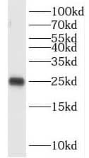 Western Blot: OIP5 Antibody - BSA Free [NBP3-47261] - HEK-293 cells were subjected to SDS PAGE followed by western blot with (OIP5 antibody) at dilution of 1:2000
