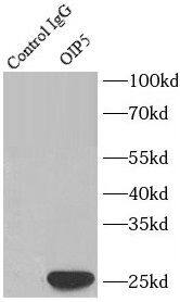 Immunoprecipitation: OIP5 Antibody - BSA Free [NBP3-47261] - IP Result of anti-OIP5 (IP:, 3ug; Detection: 1:500) with Jurkat cells lysate 3200ug.
