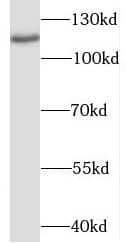 Western Blot: OGDHL Antibody - BSA Free [NBP3-47263] - Mouse kidney tissue were subjected to SDS PAGE followed by western blot with (OGDHL antibody) at dilution of 1:500