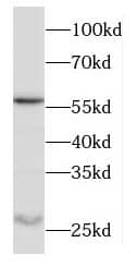 Western Blot Odf1 Antibody - BSA Free