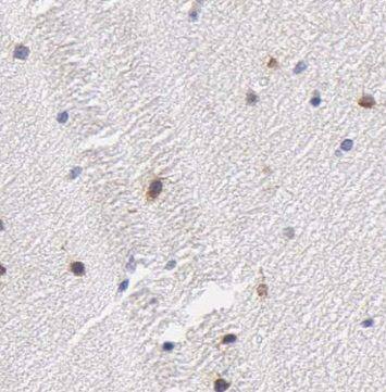 Immunohistochemistry: OAS3 Antibody - BSA Free [NBP3-47272] - Immunohistochemistry of paraffin-embedded human brain tissue slide using (OAS3 Antibody) at dilution of 1:50