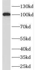 Western Blot: OAS3 Antibody - BSA Free [NBP3-47272] - A375 cells were subjected to SDS PAGE followed by western blot with (OAS3 antibody) at dilution of 1:800
