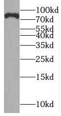 Western Blot: NYAP2 Antibody - BSA Free [NBP3-47273] - Mouse brain tissue were subjected to SDS PAGE followed by western blot with (NYAP2 Antibody) at dilution of 1:1000